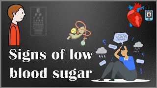 Signs That You Have Low Blood Sugar Hypoglycemia [upl. by Dacy]