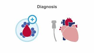 Endocarditis 101 Diagnosis and Treatment [upl. by Ssilem]