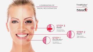 Fotona 4D NYC NonInvasive Laser Treatment for Facelift Neck Lift Lip Plumping Skin Tightening [upl. by Nosned]