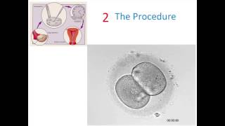 Is Infertility a Disease HighTech Cures amp Miracles [upl. by Chloras]