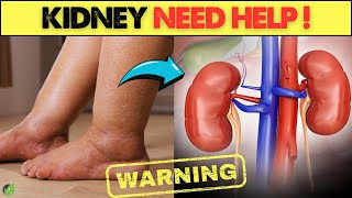 7 Skin Warning Signs That Your Kidneys May Be In DANGER  Health Journey [upl. by Odnam]