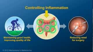 Chronic Inflammation in IBD and How AntiTNF Therapy Works [upl. by Samaj]