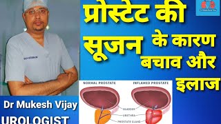 प्रोस्टेट की सूजन के कारण बचाव और उपाय prostatitis treatment causes risk factor in hindi  CPPS [upl. by Aroved]