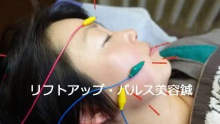 電気パルス美容鍼はリフトアップしたい方におススメ♪ [upl. by Ecilegna]