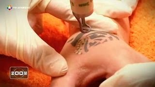 Cómo borrar tatuajes con láser [upl. by Aldora]