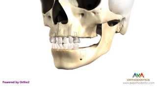 Teeth Eruption Pattern from Primary to Permanent Dentition [upl. by Ihel]