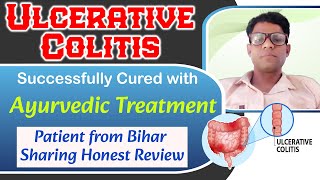 Ulcerative Colitis Ayurvedic Treatment Successfully Cured Patient From Bihar Sharing Honest Review [upl. by Yunick32]