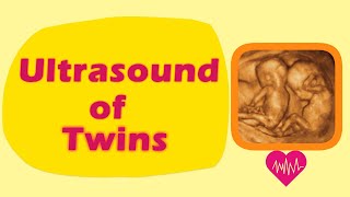 Sonography of Twins [upl. by Devad]