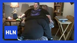 Watch The man with the 100lb scrotum [upl. by Zena]