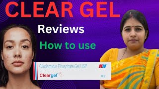 Clear gel pimples or acne treatments kaise use karte hai precautions iske substitute side effects [upl. by Jasisa]