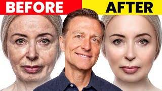 The Ultimate Face Transformation–Dr Bergs Best Remedy for Dry Skin and Wrinkles [upl. by Zilevi]