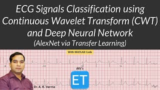 ECG Signals Classification using Continuous Wavelet Transform CWT and Deep Neural Network [upl. by Arahs508]