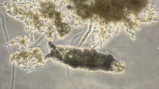 Activated Sludge microscopic exam Tardigrade Type 021N Stalked ciliates Phase contrast [upl. by Tad91]