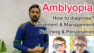 Amblyopia  Treatment amp management  patching amp penalisation [upl. by Shelli]