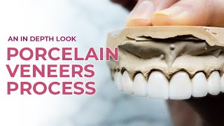 Porcelain Veneers A Dental Boutique Process  An In Depth Look [upl. by Emmer]