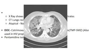 Respiratory Pneumocystis Jirovecii English [upl. by Conrado544]