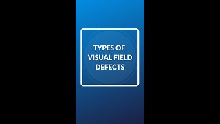 Types of visual field defects shorts optometry optomyze [upl. by Eustashe]