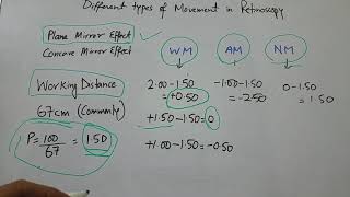 Different types of movement in Retinoscopy [upl. by Attayek377]