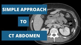 How to read a CT Abdomen  Part 2 [upl. by Ttelracs191]