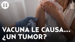 Vacuna Covid 19  Hombre de 65 años recibe dosis de Pfizer y le aparece un tumor en el brazo [upl. by Suzanne]