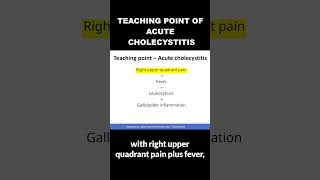 Teaching Point of Acute Cholecystitis  MCCQE1 [upl. by Ylrak]