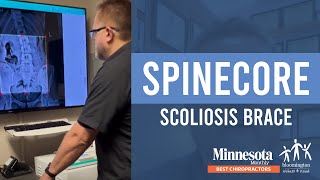 SpineCor Scoliosis Brace Revolutionary NonSurgical Treatment  Scoliosis Solutions of Minnesota [upl. by Harleigh193]