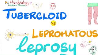 Leprosy  Tuberculoid Leprosy vs Lepromatous Leprosy  Comparisons Playlist [upl. by Goodspeed]