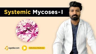 Systemic Mycoses I  Infectious Medicine  Clinical Video Lectures  Medical VLearning [upl. by Merell]