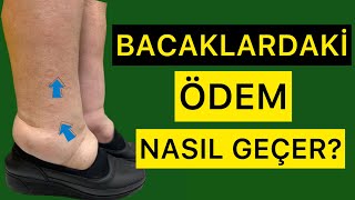 BACAKLARDAKİ ÖDEM NASIL GEÇERDOLAŞIMI ARTIR fizyoterapistmacide ödem [upl. by Ayotnom]