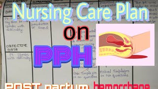 NCP on Postpartum hemorrhage  Nursing Care Plan On post partum hemorrhage NCP on PPH pph [upl. by Eerdua]