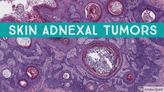 Skin Adnexal Tumors Dermatopathology Unknown Cases [upl. by Enylodnewg]