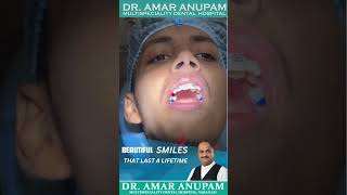 Services At Dr Amar Anupam Multispeciality Dental Hospital Best Dentist In Varanasi [upl. by Tyrrell]