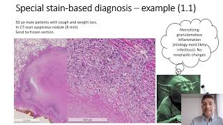 Diagnosis of infectious diseases in pathology laboratory Routine practice and emerging aspects [upl. by Iggep]