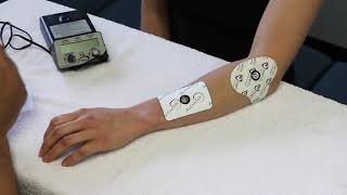 How to set up Iontophoresis [upl. by Siuqaj]