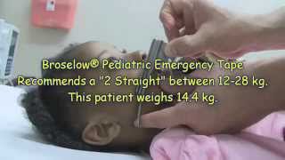 Pediatric Laryngoscope Blade Length Selection [upl. by Matti]