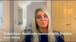 Isotretinoin for seborrheic eczema  Dermatologist explains [upl. by Oremodlab297]