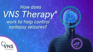 How does VNS Therapy Epilepsy Treatment Work [upl. by Urion983]