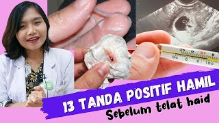 13 Tanda Positif Hamil sebelum Telat Haid  dr Emasuperr [upl. by Oine]