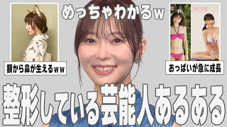 【ガルちゃん芸能】共感しかないｗｗ整形している芸能人あるあるを紹介【ゆっくり解説】 [upl. by Corney]