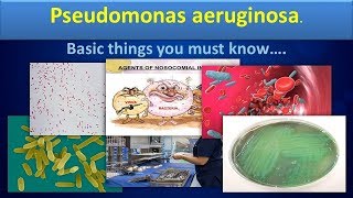 Pseudomonas aureginosaClear overview [upl. by Nniroc]