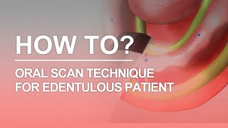 Edentulous Scan DIOnavi Learning Contents [upl. by Brinn89]