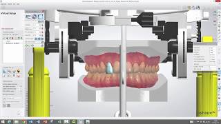 3Shape Ortho Analyzer  How to Use the Virtual Articulator in Ortho Analyzer [upl. by Ahpla]