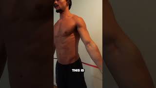 HOW TO FIX MILD PECTUS EXCAVATUM [upl. by Garnette178]