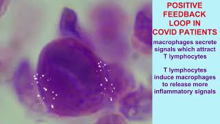 MACROPHAGES MONOCYTES IN VIRAL PNEUMONIA microscope slides [upl. by Aimit]