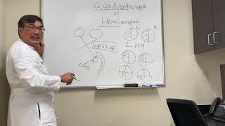 Quadrantanopia vs hemianopia [upl. by Kennard]