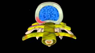 How Spinal Traction Helps Disc Decompression and Relieve Back or Neck Pain [upl. by Feenah]