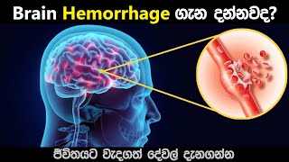 මොළයේ රුධිර වහනය 😨 Brain Hemorrhage  symptoms  causes and treatment sinhala [upl. by Sandro]