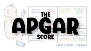 Apgar Score Made Easy  newborn assessment calculation interpretation limitations mnemonic [upl. by Idolem]