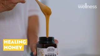 Surprising uses for manuka honey [upl. by Enidan539]