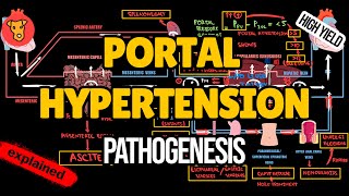 PORTAL HYPERTENSION Pathogenesis Hemodynamics Clinical symptoms Stages Classification [upl. by Erinn]